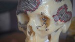 Особый взгляд: белорусские ученые изобрели новый метод глазного протезирования